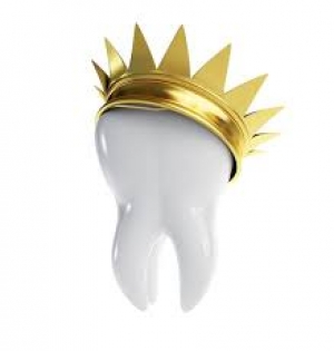 Ø¯Ù†Ø¯Ø§Ù†Ø³Ø§Ø²ÛŒ Ù†Ú¯ÛŒÙ† 